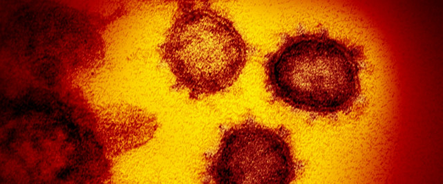 Испытан препарат, снижающий накопление коронавируса в 5000 раз
