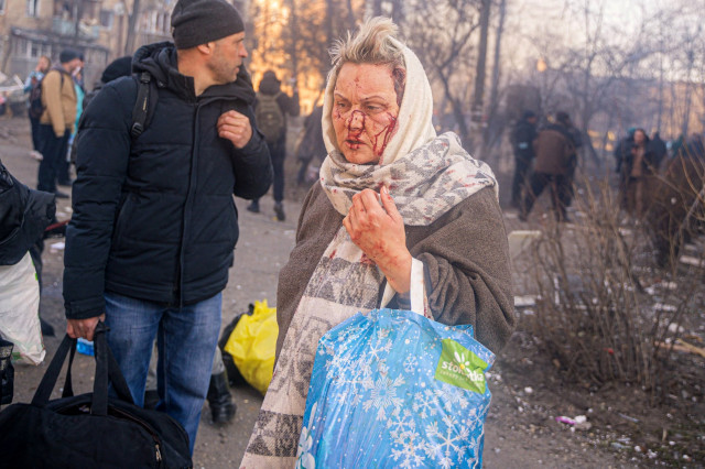 Последствия войны: около 15 миллионам украинцев понадобится психологическая помощь - Минздрав