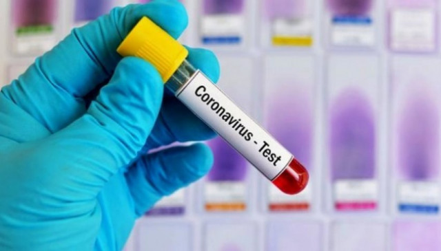 Ukraine reports 14,575 new coronavirus cases